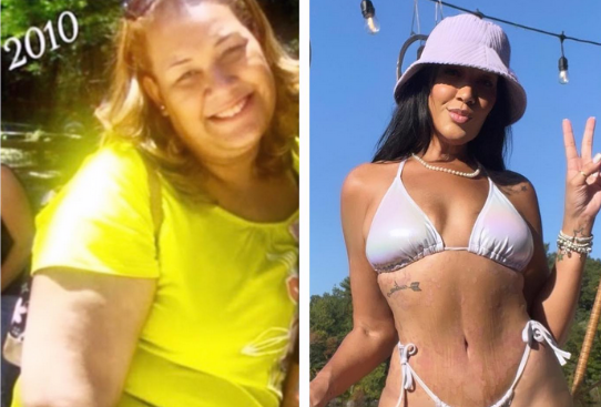 Murió Mila de Jesús, brasileña que impactó con su transformación física