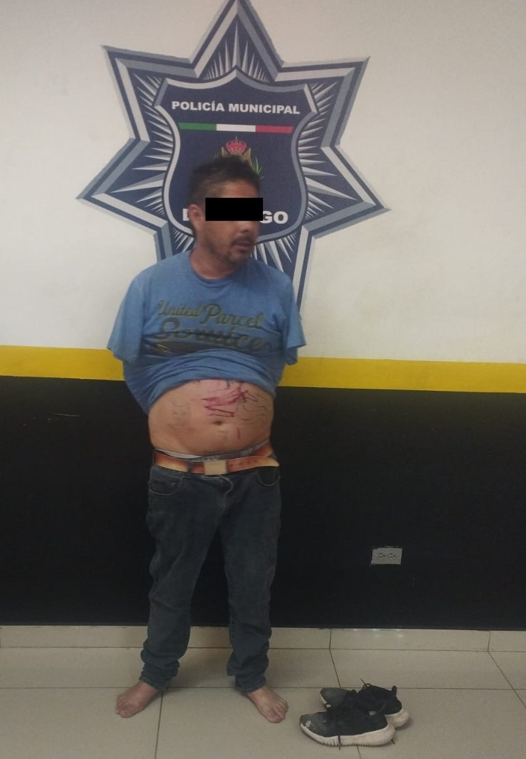 Caso. Fingió lesiones y le mandó fotos a su amiga, se activaron los cuerpo del orden y de auxilio y todo se trató de una broma.