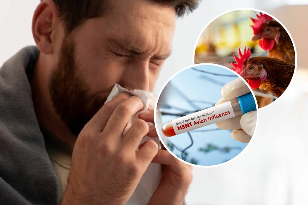 ¿Se puede contagiar la Gripe Aviar (H5N1) en humanos?