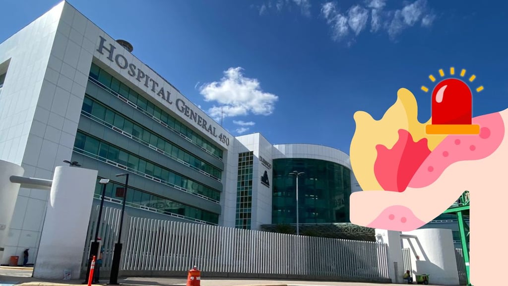 Mecánico es atendido en el HG450 tras sufrir quemaduras por un accidente laboral