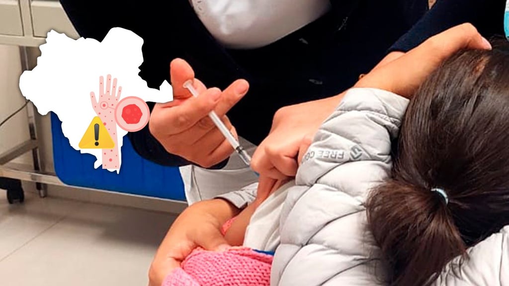 Hay 9 casos de sarampión confirmados en Durango; ¿qué municipios son los afectados?