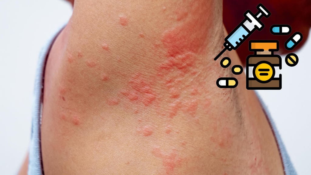 Registradas 163 sospechas de reacciones adversas a medicamentos desde 2022 en Durango