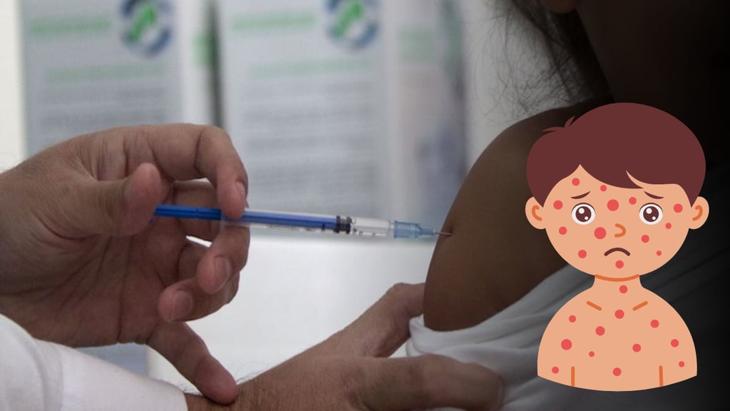 Durango cierra filas contra sarampión; llaman a reforzar vacunación