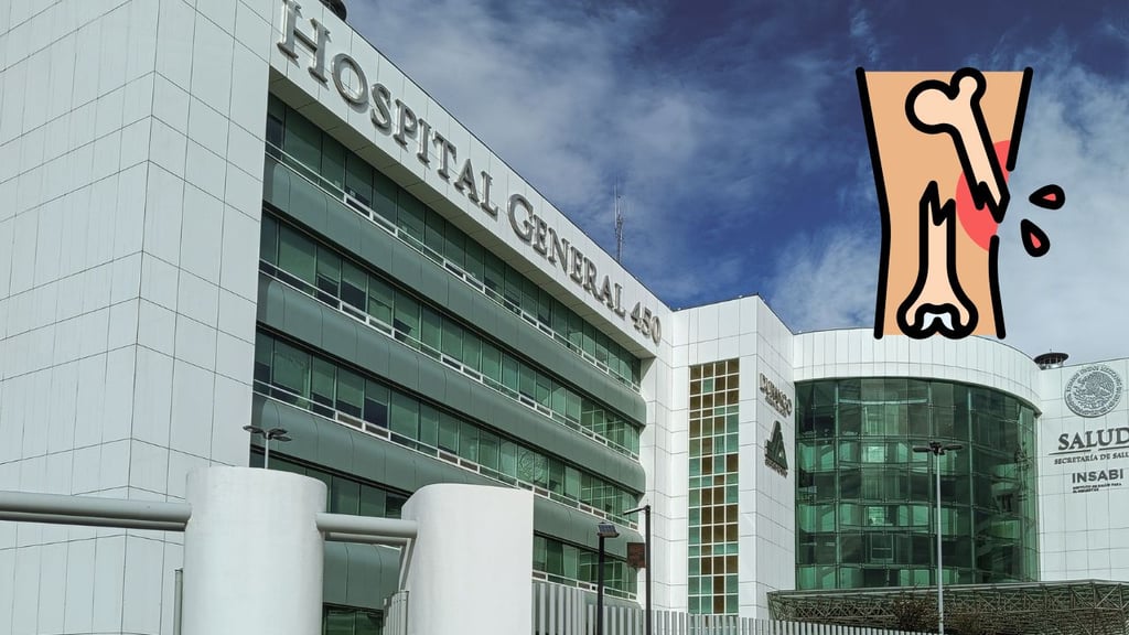 Motociclista adolescente resulta lesionado tras choque con vehículo que se dio a la fuga