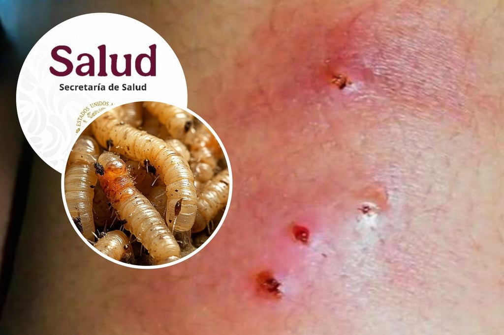 Gusano Barrenador: reportan a la primera persona contagiada en Yucatán