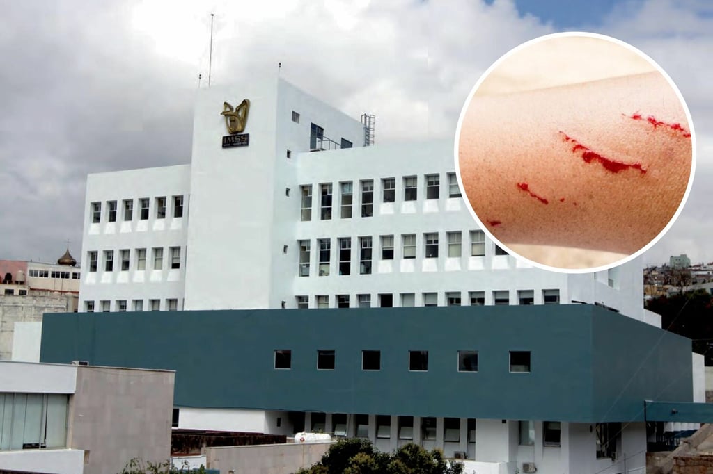 Fallece joven de 17 años por caso de rabia en Zacatecas