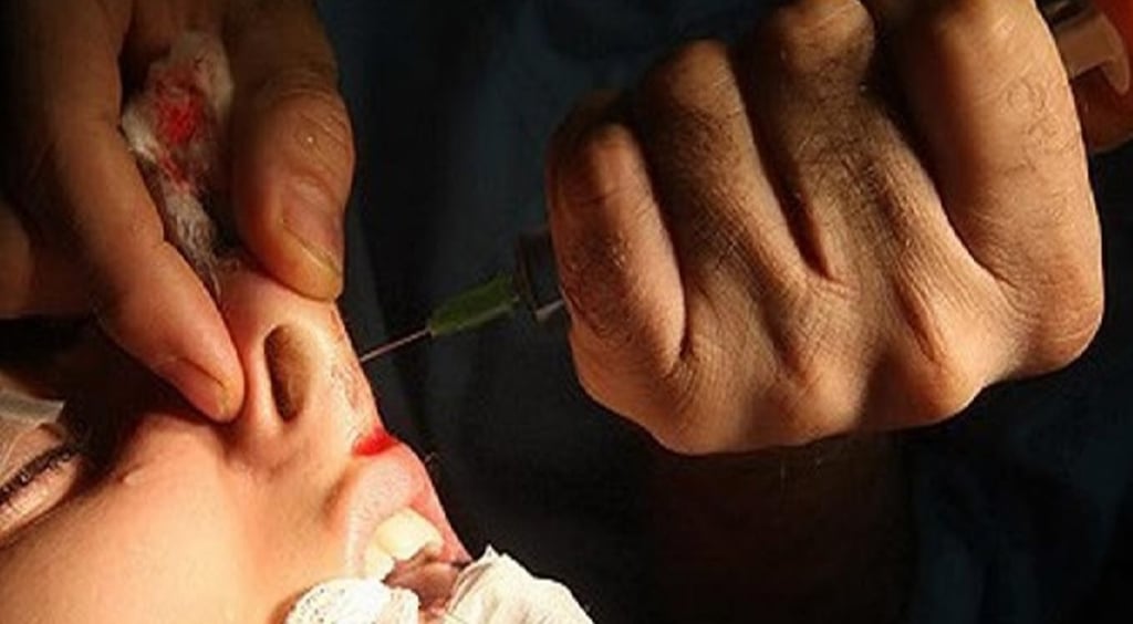 Aspectos. La ley no establece edades para las cirugías estéticas en menores de edad, aunque especialistas hablan sobre la ética y no realizarlas en adolescentes, a menos de que sea después de algún accidente y como reconstrucción de alguna parte del cuerpo.