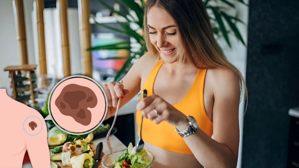 ¿El cáncer de piel se relaciona a la alimentación? Esto dice la ciencia