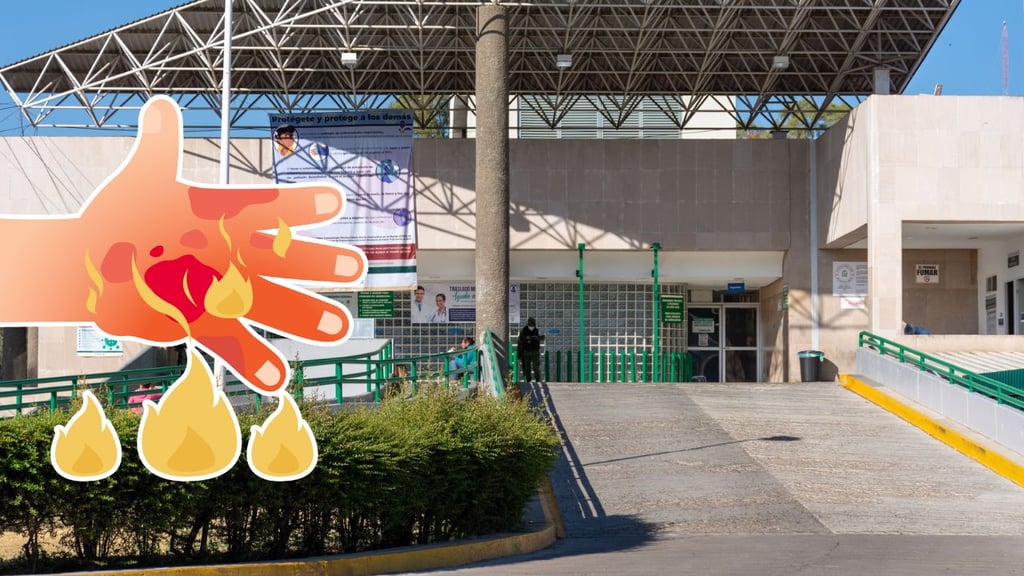 Niña de 5 años ingresa al IMSS de Durango con quemaduras de segundo grado; investigan causas