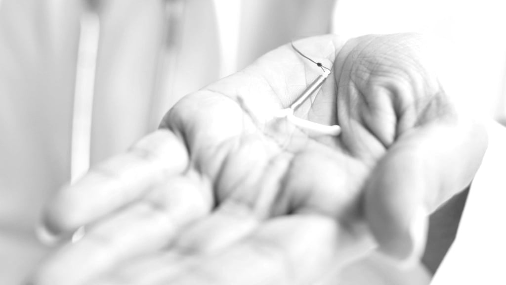 Planificación. De acuerdo con la salud de cada paciente se sugiere el método a utilizar.