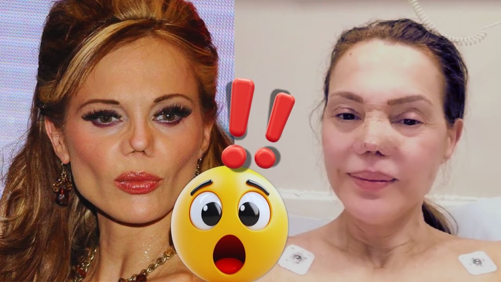 Carmen Campuzano impacta con su nueva imagen tras una exitosa cirugía estética