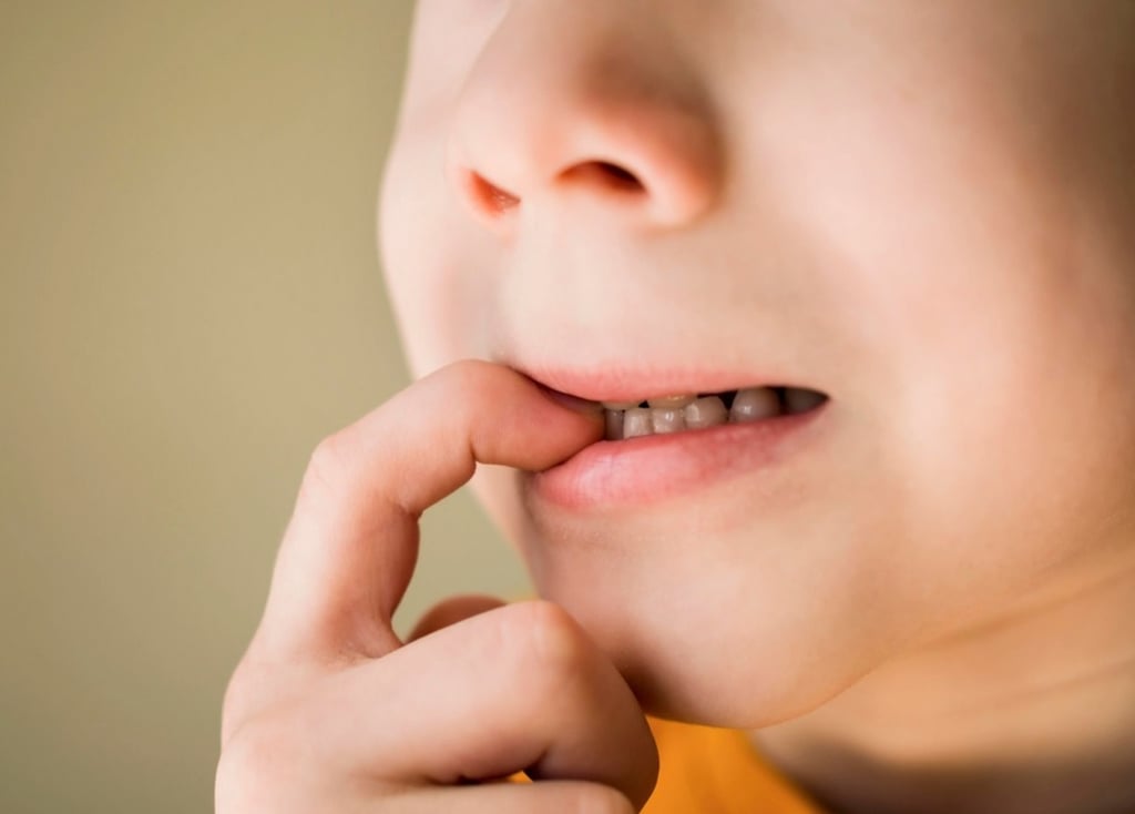 Problemática. Es necesario fortalecer la cultura de salud bucal en el estado, pues tener 89?% de adultos y 73?% de menores con caries evidencia un problema de gran magnitud.