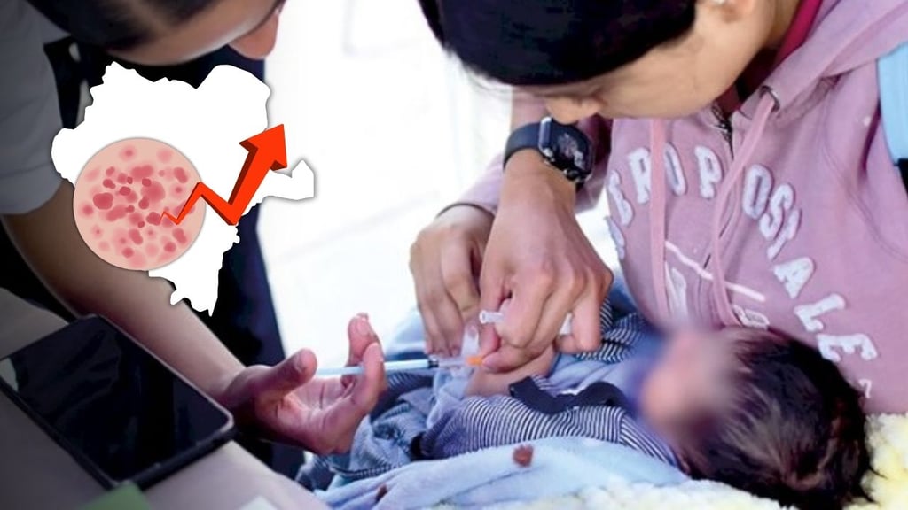 Durango registró la letalidad por sarampión más alta en 2025