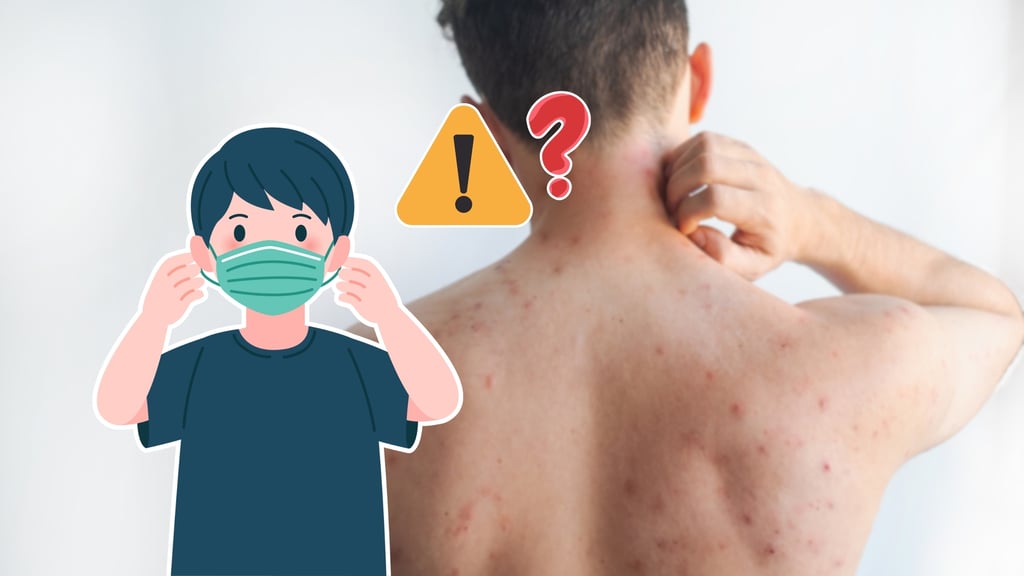 Sarampión: ¿puedes volver a contagiarte si ya lo padeciste?