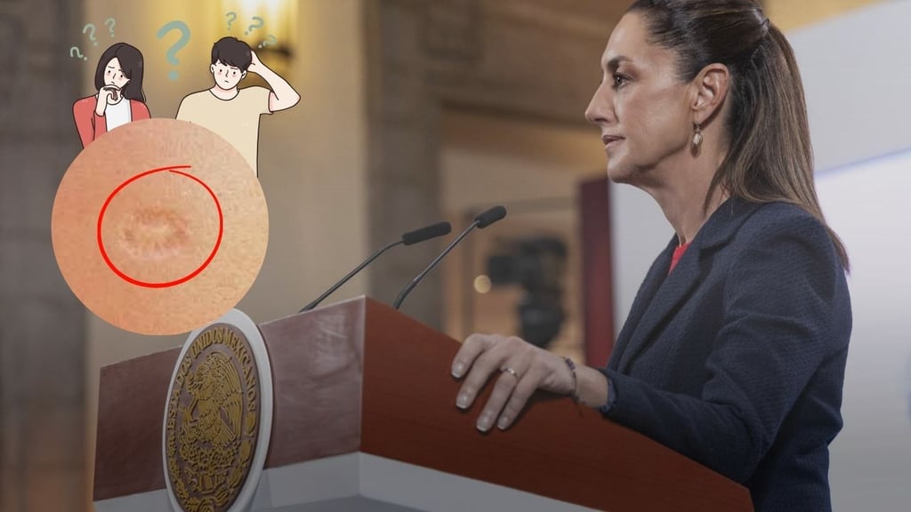 ¿La cicatriz en el hombro no es de sarampión? Sheinbaum aclara este mito médico