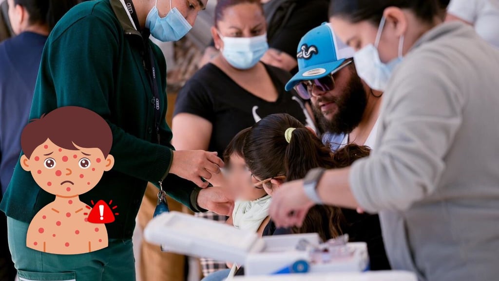 Seis de cada 10 casos de sarampión en Durango son en menores de 12 años