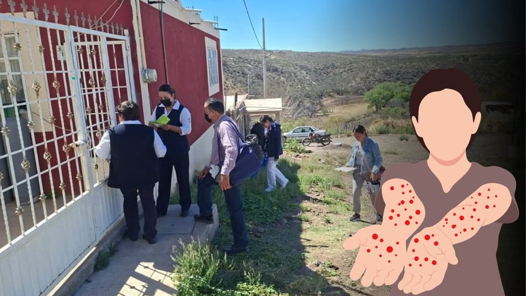 Durango reporta 108 casos de sarampión; 16 casos fueron confirmados este fin de semana