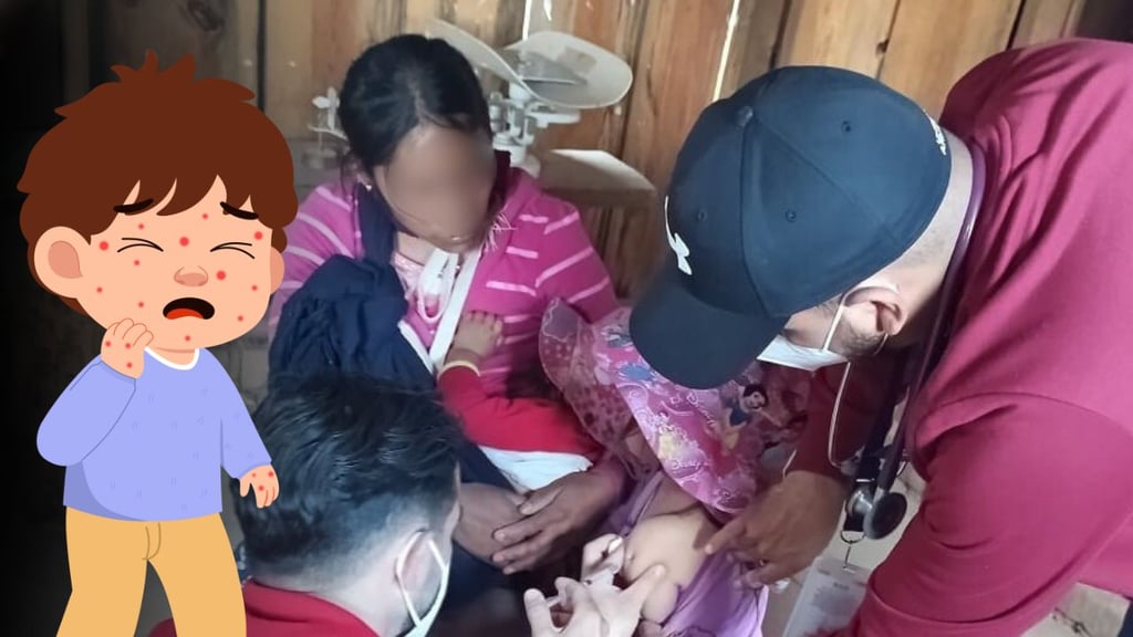 Durango reporta 7 casos más de sarampión en 24 horas; seis pacientes son niños