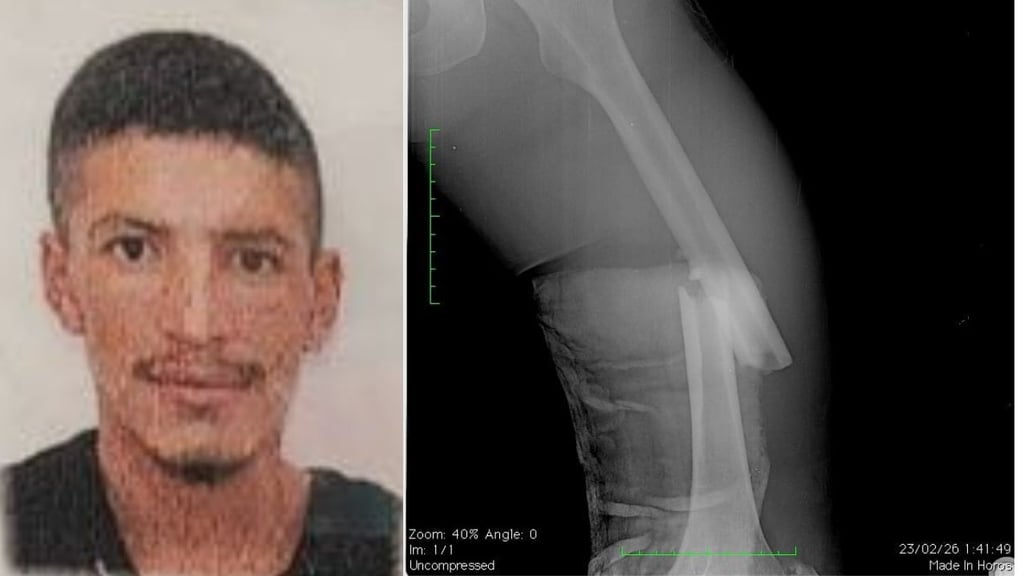 Hombre pide ayuda tras ser atropellado; es de Guanaceví y está en la capital, sin dinero ni comida