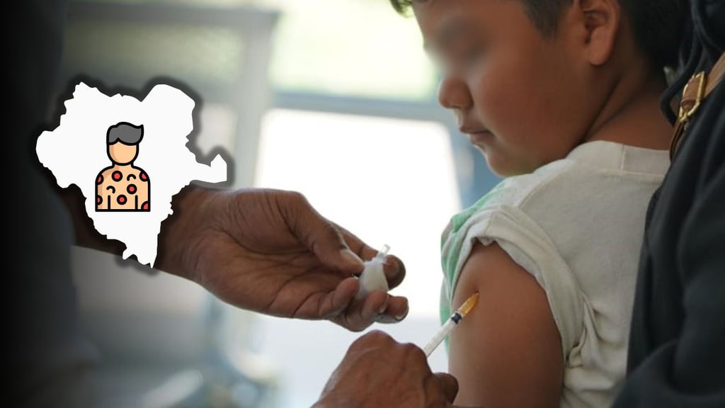 Casos de sarampión van a la baja en Durango; piden mantener precaución en vacaciones de Semana Santa 2026