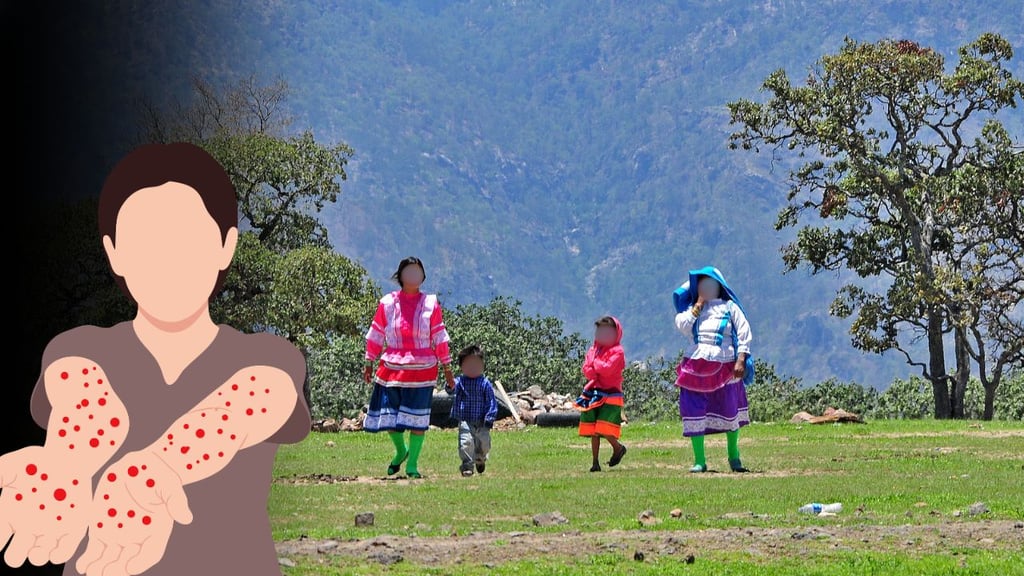 Sarampión en Durango: realizan cerco de salud en Mezquital