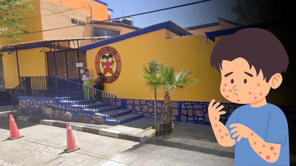 Reportan brote de varicela en primaria del sistema CADI, en Durango