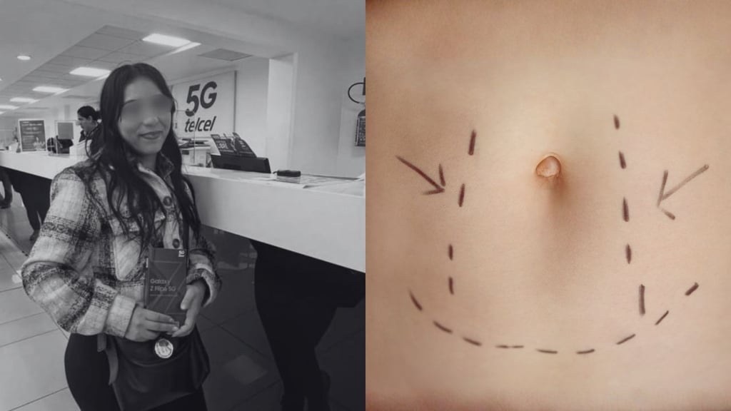 Falsa doctora ofrecía lipos exprés: así operaba en la clínica donde desapareció Blanca Adriana