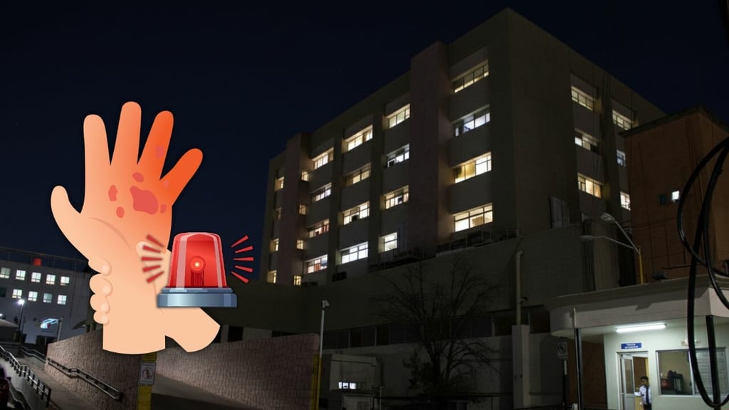 Ingresa al Materno Infantil niño de 7 años con quemaduras de segundo grado