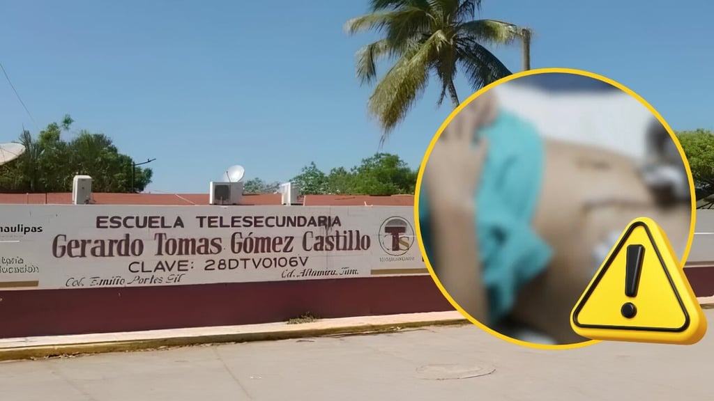 Estudiante de 13 años pierde un riñón tras golpiza de dos de sus compañeros