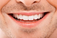 Alimentos que limpian los dientes naturalmente