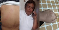 Señalan agresión contra representante de Grupo Vida