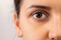 Prueba estos remedios si quieres eliminar las ojeras