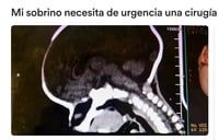¡Ayuda a Santi! Necesita reunir 150 mil pesos para costear una cirugía en su cabecita