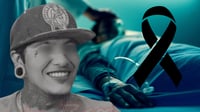 Joven de 24 años muere tras sufrir severa infección dental