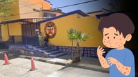 Reportan brote de varicela en primaria del sistema CADI, en Durango