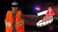 Sujeto muerde el rostro de su expareja tras discusión por celos; ocurrió en Durango