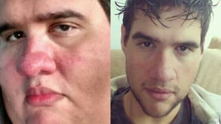 Influencer bajó casi 200 kilos, cayó en depresión y murió al retomar vida fitness