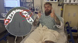 Paul vs Joshua: el influencer confirma una doble fractura de mandíbula tras perder ante A.J.