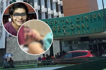 Caso Melanie: Fue intervenida para tratar de salvar su ojo, revela familia | VIDEO