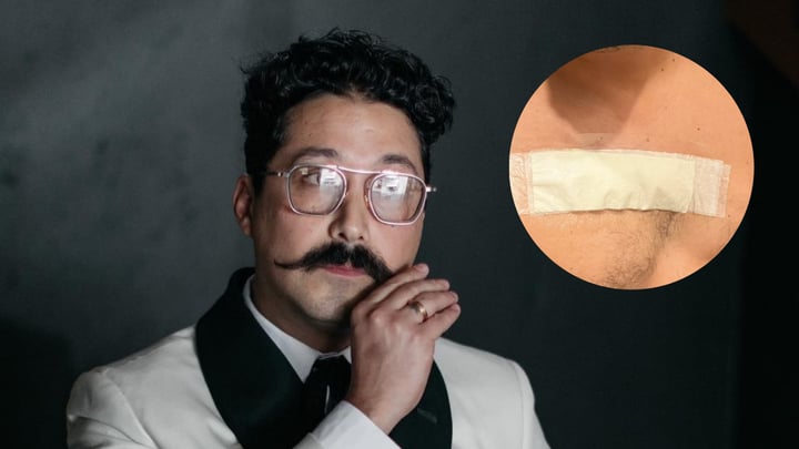 ¿Qué enfermedad tiene Mau Nieto? Comediante e integrante de 'Me Caigo de Risa'