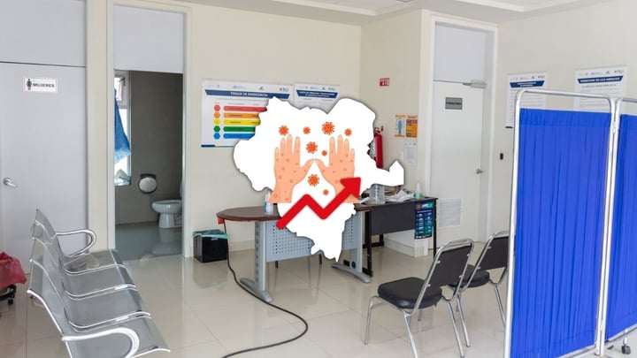 Durango ya suma 17 casos positivos de sarampión; estos dos municipios son los afectados