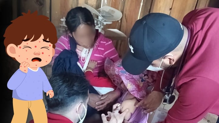 Durango reporta 7 casos más de sarampión en 24 horas; seis pacientes son niños