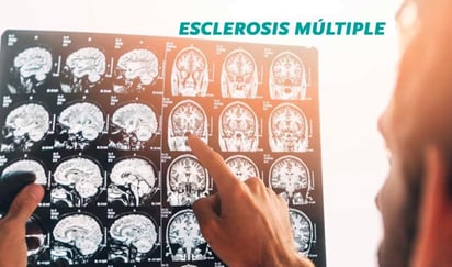Enfermedad. Esta enfermedad no es muy común y en los últimos tres años y medio se han detectado en la entidad 22 casos, principalmente en mujeres; en el 2023 fueron 14 casos detectados.
