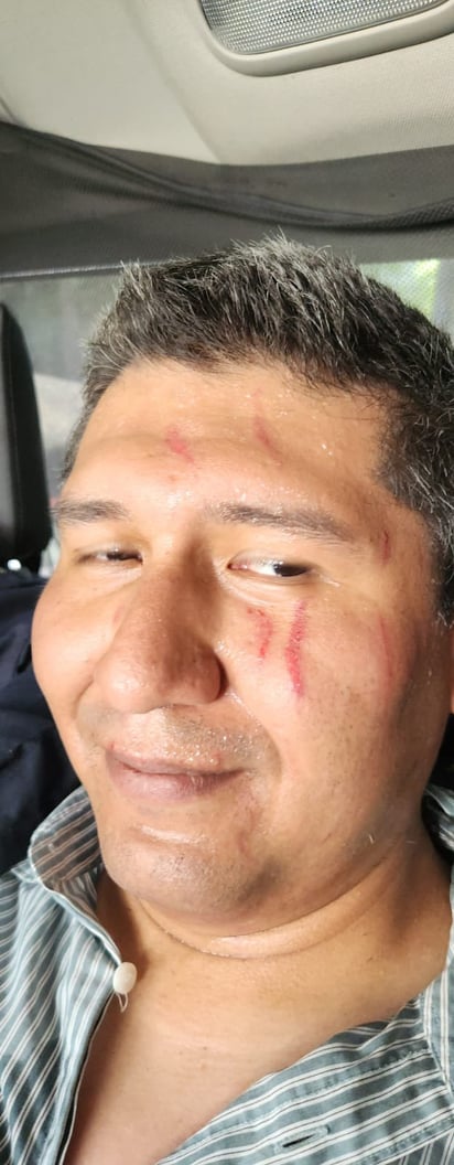 Así lucía Miguel Cortés Miranda tras su arresto. Destaca que los rasguños en su rostro fueron hechos por sus últimas dos víctimas.