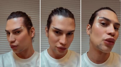 Junior Dutra era conocido por sus operaciones estéticas, pues esta no era la primera que se había realizado.