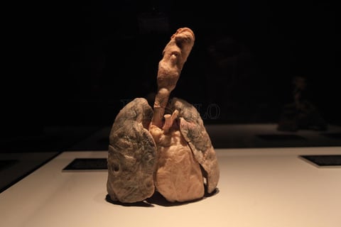 &lsquo;Our Body&rsquo; lleva a un viaje al interior del cuerpo humano, donde los visitantes podr&aacute;n conocer los misterios de la anatom&iacute;a a trav&eacute;s de un recorrido por seis diferentes salas.