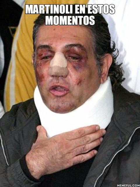Aseguran que as&iacute; se ve Martinoli tras la pelea.