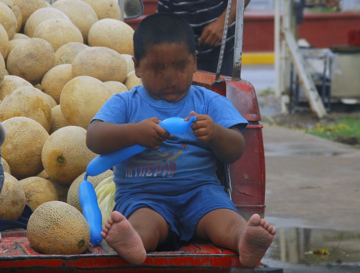 Llaman A Evitar La Obesidad Infantil Llaman A Evitar La Obesidad Infantil
